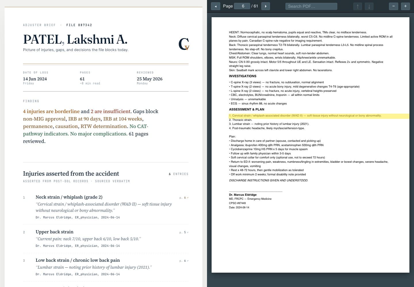 Claims Velocity medical record review with a cited finding highlighted beside its source PDF